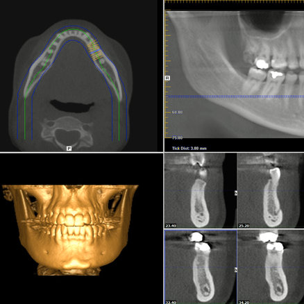 Centro Odontoiatrico Laudense - Radiografia e tomografia a Lodi